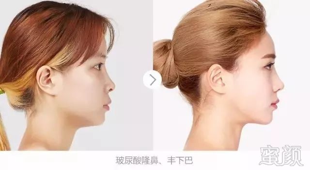 https://img.miyanlife.com/mnt/timg/180501/112630ON-12.jpg