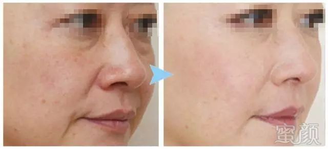https://img.miyanlife.com/mnt/timg/180501/113G263T-6.jpg
