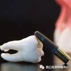https://img.miyanlife.com/mnt/timg/180501/113P62356-0.jpg