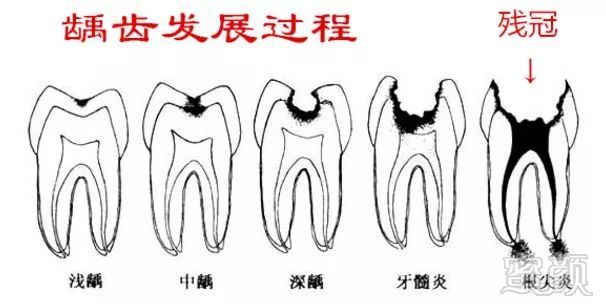 案例图片