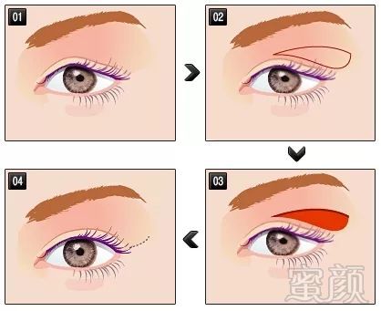 https://img.miyanlife.com/mnt/timg/180501/114J15U3-4.jpg