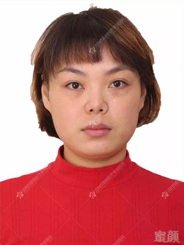 https://img.miyanlife.com/mnt/timg/180501/1210292309-0.jpg