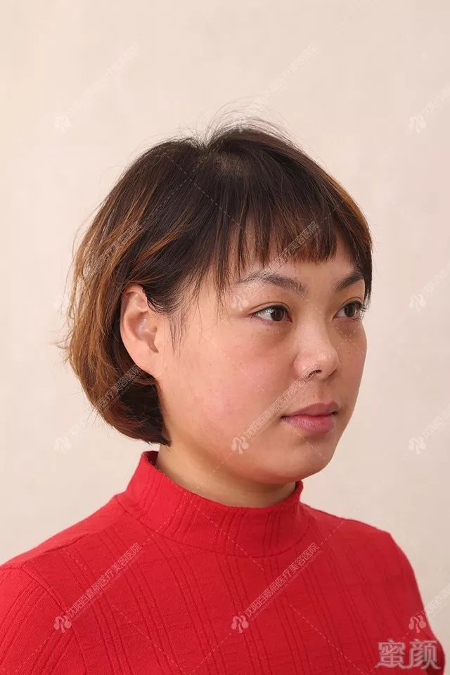 https://img.miyanlife.com/mnt/timg/180501/12103043M-1.jpg