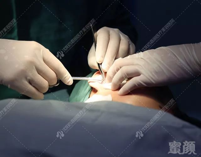 https://img.miyanlife.com/mnt/timg/180501/121034LV-9.jpg