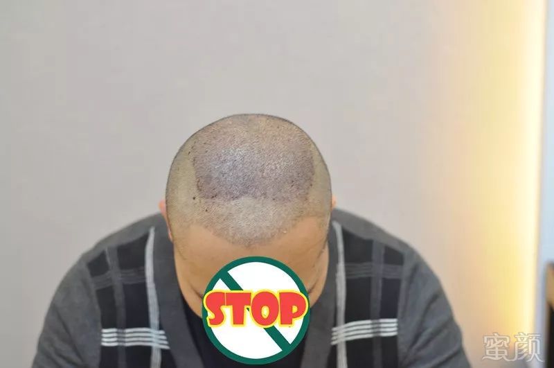 https://img.miyanlife.com/mnt/timg/180501/1226134G0-4.jpg