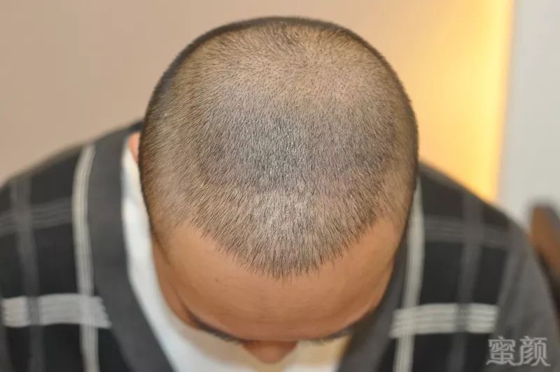 https://img.miyanlife.com/mnt/timg/180501/122614DJ-6.jpg