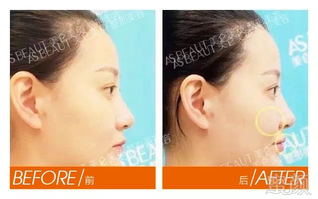 https://img.miyanlife.com/mnt/timg/180501/122T93G8-5.jpg