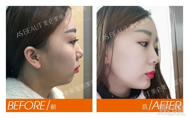 https://img.miyanlife.com/mnt/timg/180501/122U0I05-8.jpg