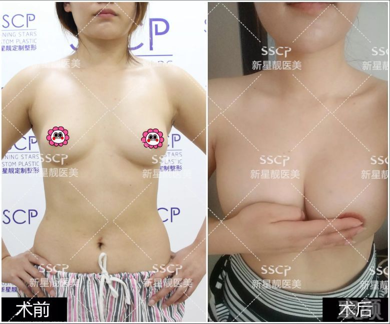 https://img.miyanlife.com/mnt/timg/180501/1242332L3-2.jpg