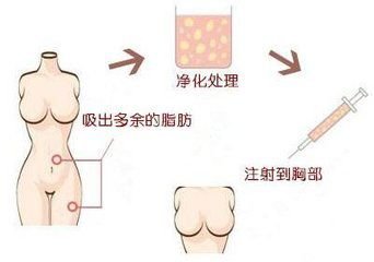 https://img.miyanlife.com/mnt/timg/180501/124233O28-1.jpg
