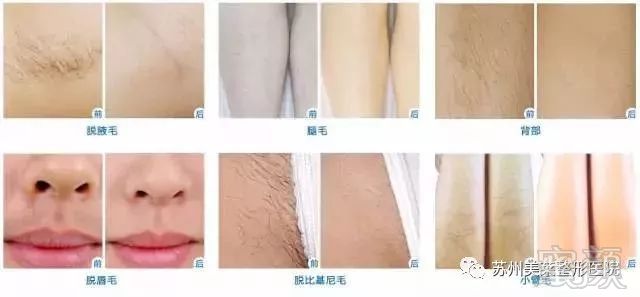 https://img.miyanlife.com/mnt/timg/180501/12423JP8-6.jpg