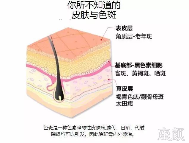 https://img.miyanlife.com/mnt/timg/180501/1250092212-3.jpg
