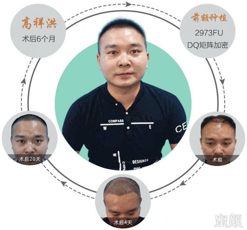 https://img.miyanlife.com/mnt/timg/180501/1255005T2-0.jpg