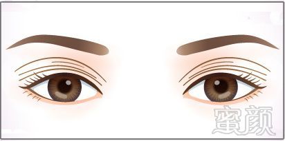 https://img.miyanlife.com/mnt/timg/180502/10252K101-6.jpg