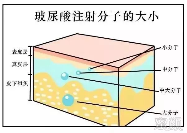 https://img.miyanlife.com/mnt/timg/180502/10400Mb6-0.jpg