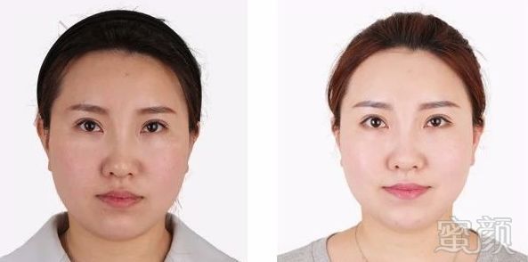 https://img.miyanlife.com/mnt/timg/180502/10400Qc1-3.jpg