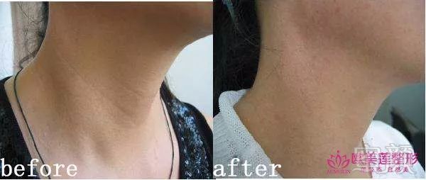 https://img.miyanlife.com/mnt/timg/180502/1041146417-8.jpg