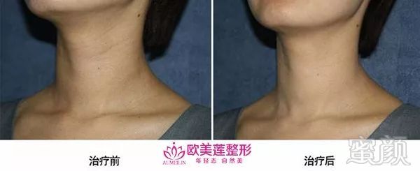 https://img.miyanlife.com/mnt/timg/180502/1041156208-12.jpg