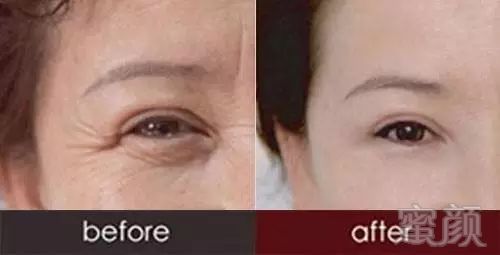 https://img.miyanlife.com/mnt/timg/180502/104I16255-1.jpg