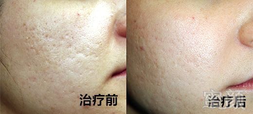 https://img.miyanlife.com/mnt/timg/180502/1054033019-4.jpg