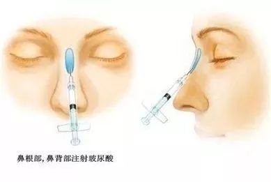 https://img.miyanlife.com/mnt/timg/180502/1055335445-3.jpg
