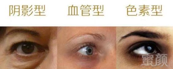https://img.miyanlife.com/mnt/timg/180502/1129146151-3.jpg