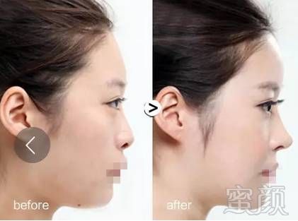 https://img.miyanlife.com/mnt/timg/180502/1131152U1-2.jpg