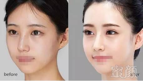 https://img.miyanlife.com/mnt/timg/180502/11311K456-6.jpg