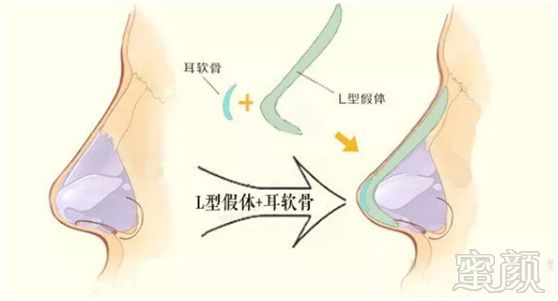 https://img.miyanlife.com/mnt/timg/180502/114P91b9-1.jpg