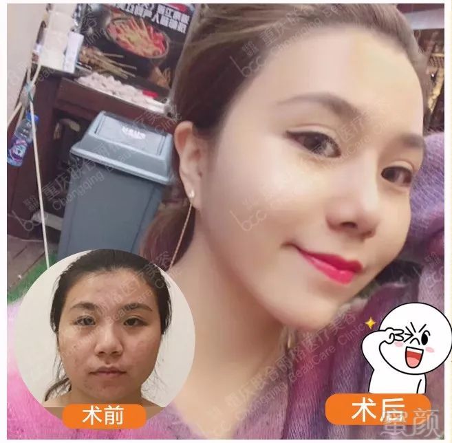 https://img.miyanlife.com/mnt/timg/180502/114PU243-0.jpg