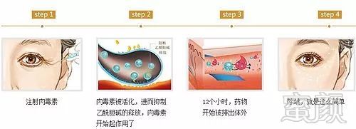 https://img.miyanlife.com/mnt/timg/180502/1154153462-3.jpg