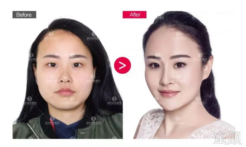 https://img.miyanlife.com/mnt/timg/180502/11541MD7-9.jpg