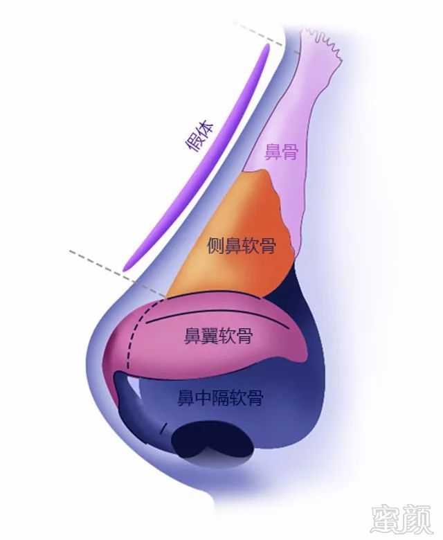 案例图片