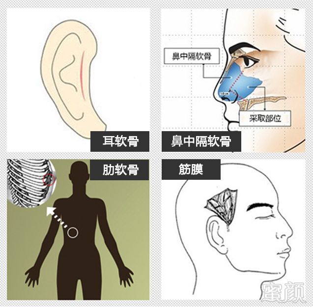 案例图片