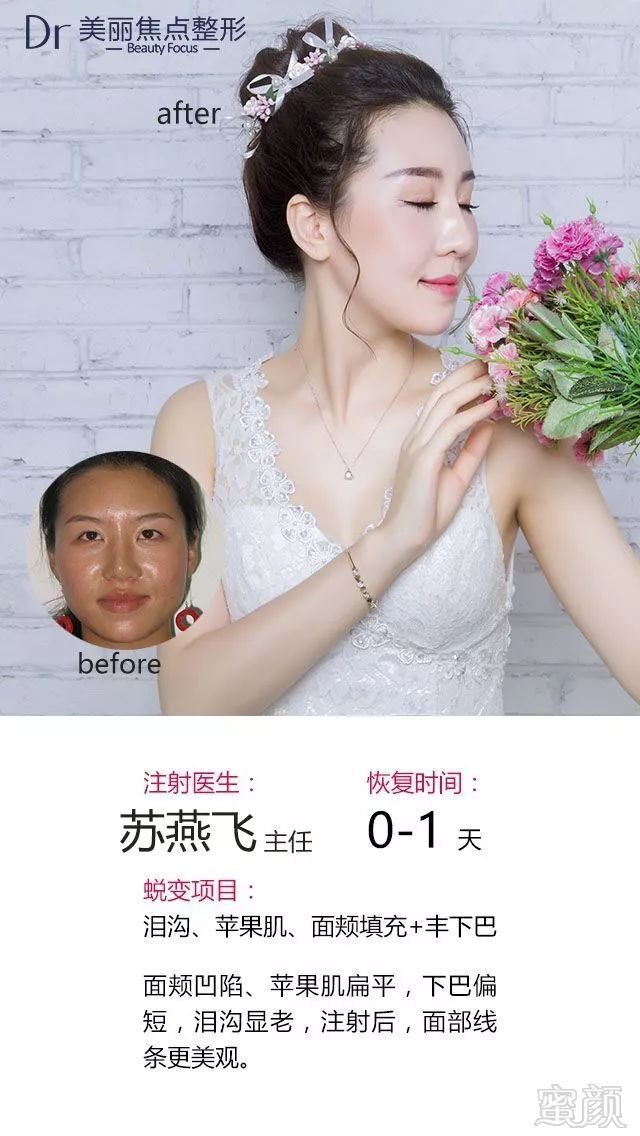 https://img.miyanlife.com/mnt/timg/180502/1205332T2-0.jpg