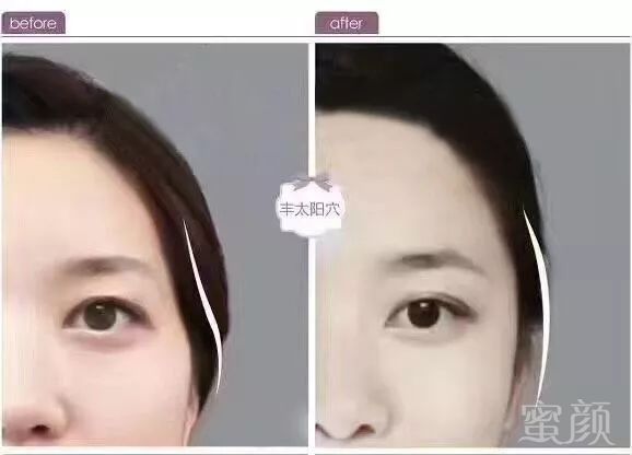 https://img.miyanlife.com/mnt/timg/180502/120534A58-2.jpg
