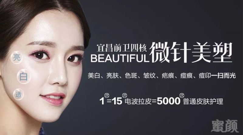 https://img.miyanlife.com/mnt/timg/180502/123F21231-7.jpg