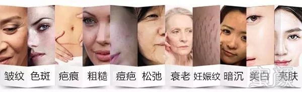 https://img.miyanlife.com/mnt/timg/180502/123F31220-11.jpg