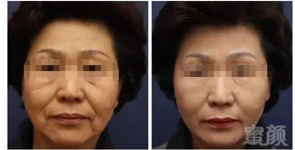 https://img.miyanlife.com/mnt/timg/180502/1406041B8-6.jpg
