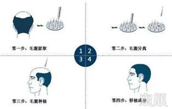https://img.miyanlife.com/mnt/timg/180503/104KKS0-1.jpg