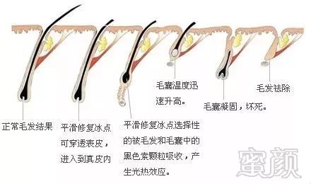 https://img.miyanlife.com/mnt/timg/180503/11451G126-11.jpg