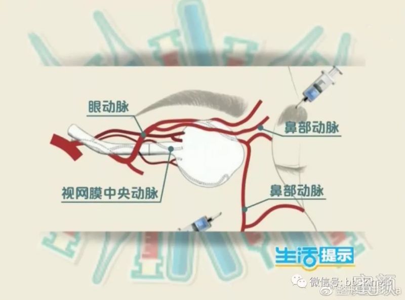 https://img.miyanlife.com/mnt/timg/180503/11451a1B-0.jpg