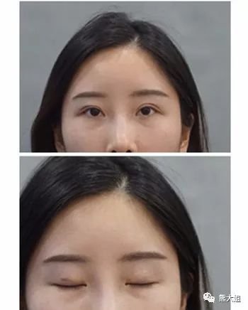 https://img.miyanlife.com/mnt/timg/180503/115Z560C-1.jpg