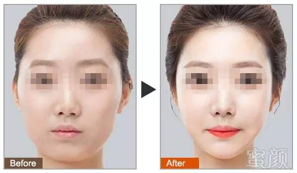 https://img.miyanlife.com/mnt/timg/180503/121R4B30-5.jpg