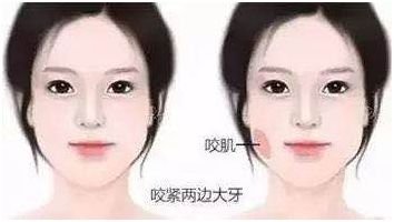 https://img.miyanlife.com/mnt/timg/180503/1233235530-1.jpg