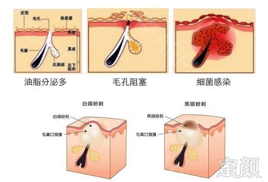 https://img.miyanlife.com/mnt/timg/180503/12363022H-2.jpg
