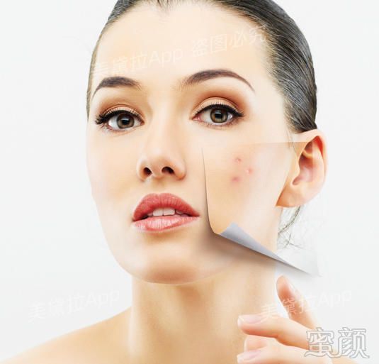 https://img.miyanlife.com/mnt/timg/180503/1236305E5-0.jpg