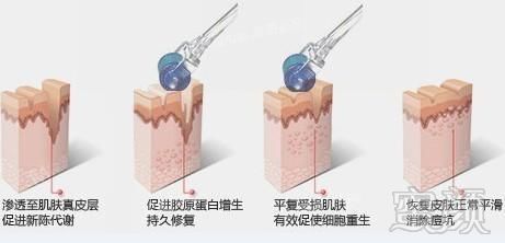 https://img.miyanlife.com/mnt/timg/180503/1236316052-3.jpg