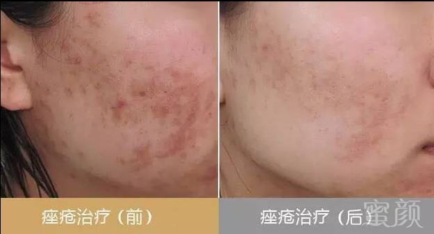 https://img.miyanlife.com/mnt/timg/180503/12363241K-8.jpg