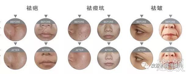 https://img.miyanlife.com/mnt/timg/180503/124HIQ9-3.jpg